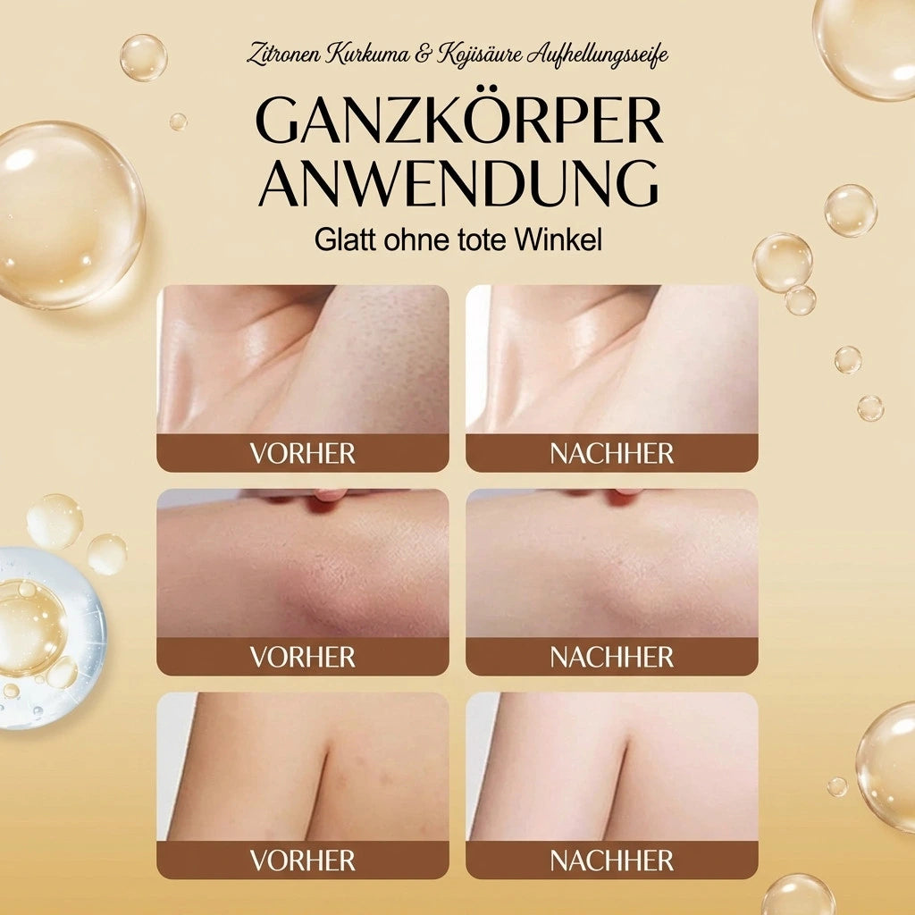 Kurkuma Kojic Seife